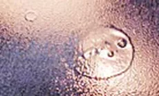 Untersuchen des Schadens