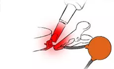 Verwendung eines Kühlkörpers