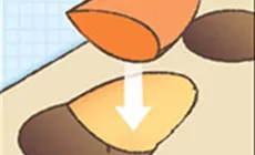 Anpassen der Füllung