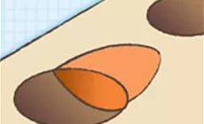 Anpassen der Füllung